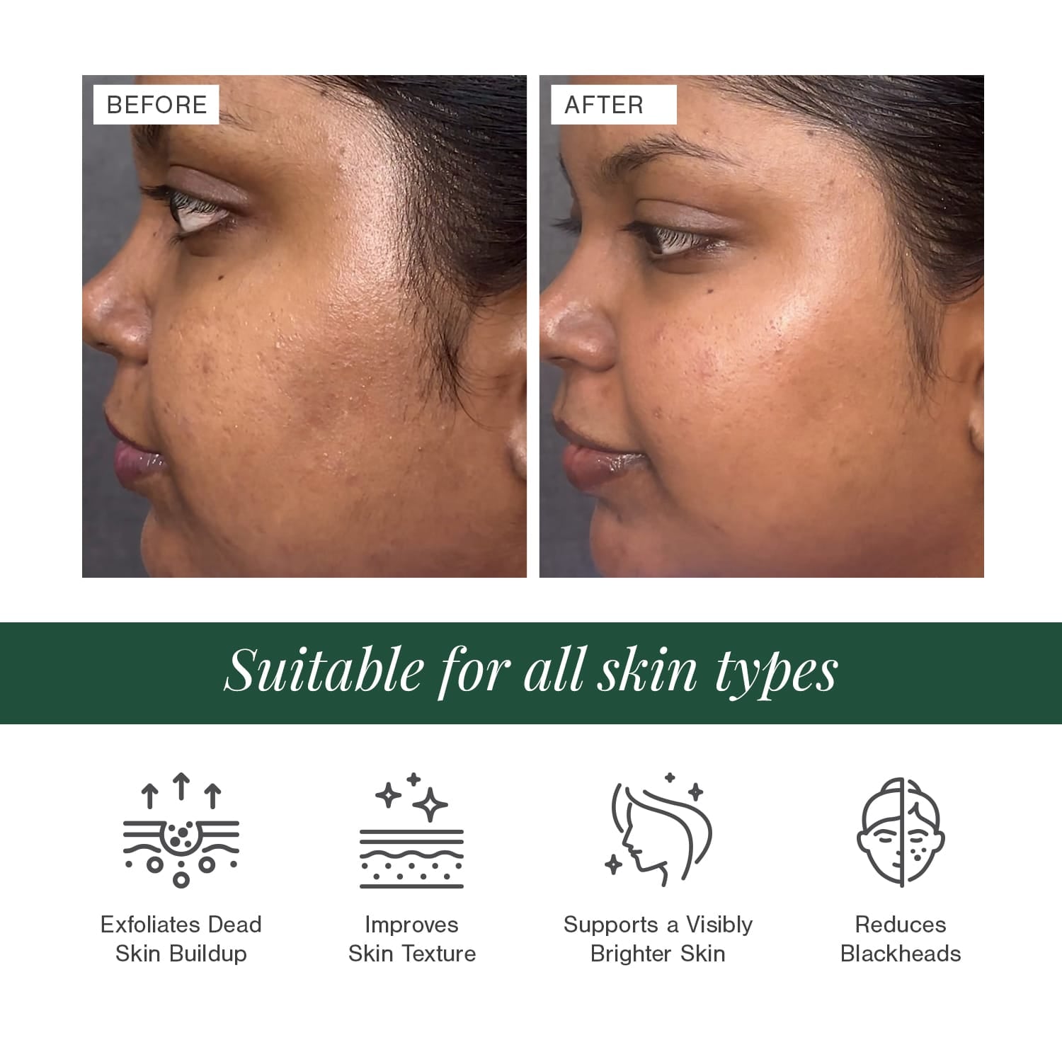 5% Lactic Acid + 3% Flower Acids Face Serum