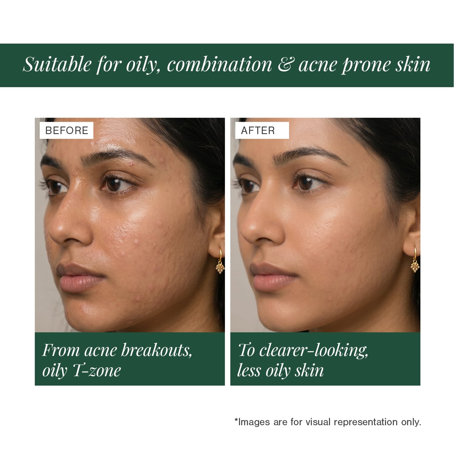 10% Niacinamide + 2% Ectoin Face Serum