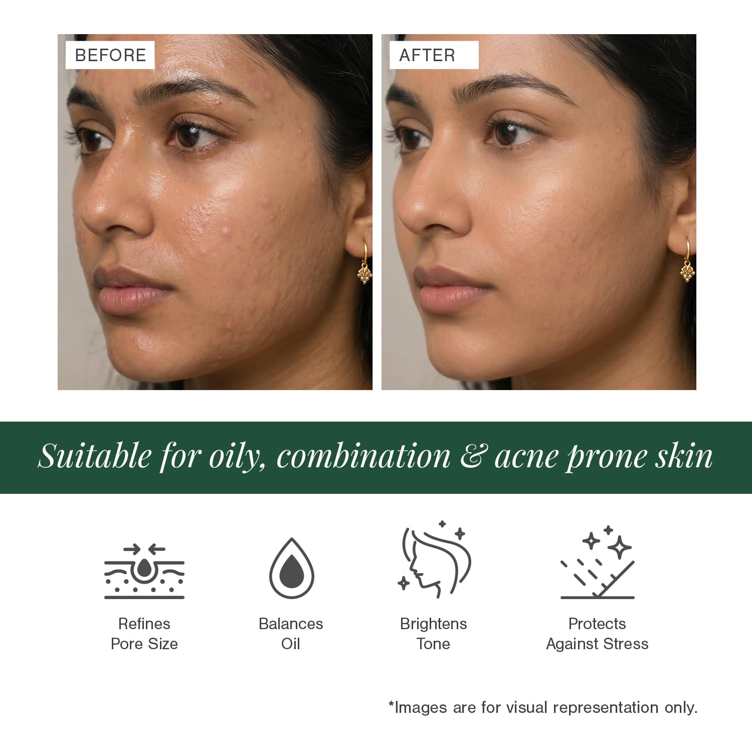 10% Niacinamide + 2% Ectoin Face Serum