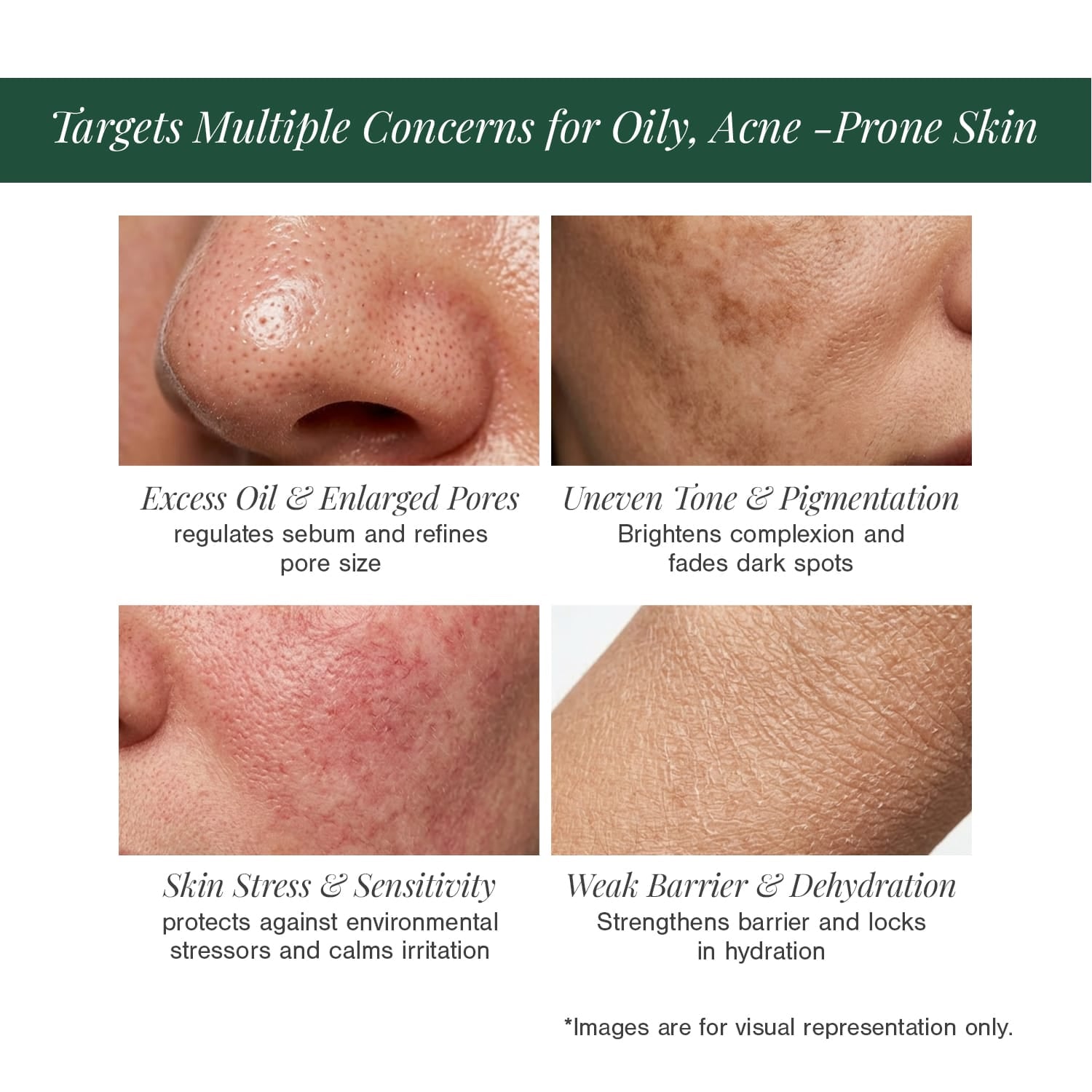 10% Niacinamide + 2% Ectoin Face Serum