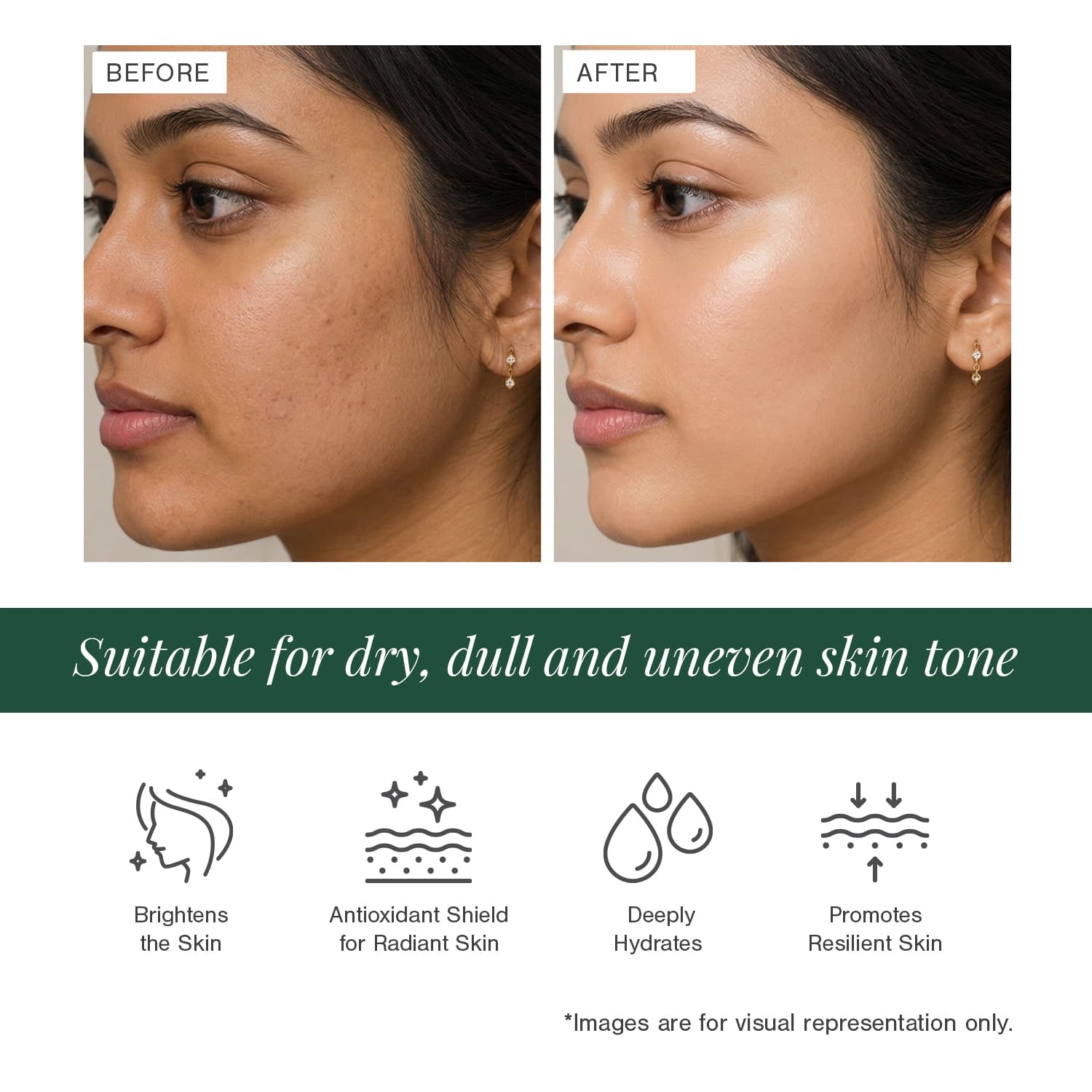 10% Vitamin C + EGCG Face Serum
