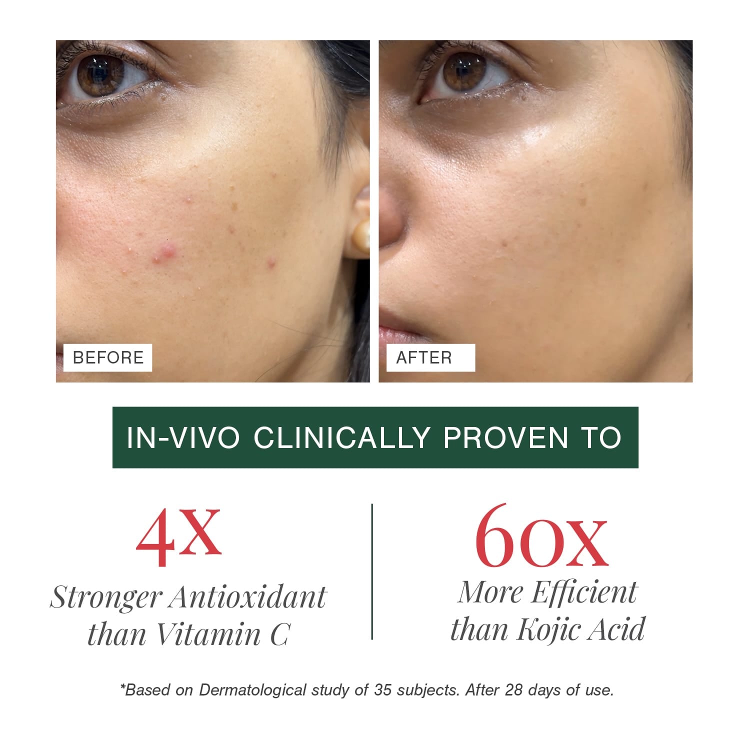 2% Alpha Arbutin + D-Gallic Acid Natural Face Serum