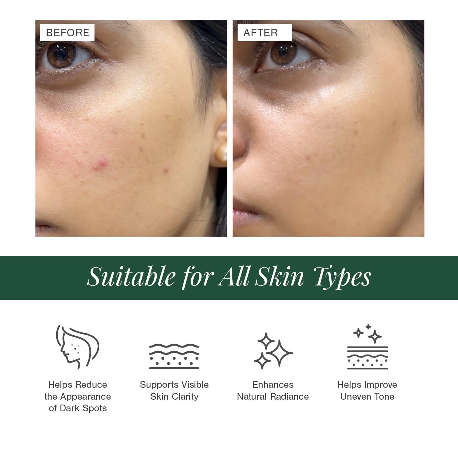 2% Alpha Arbutin + D-Gallic Acid Natural Face Serum