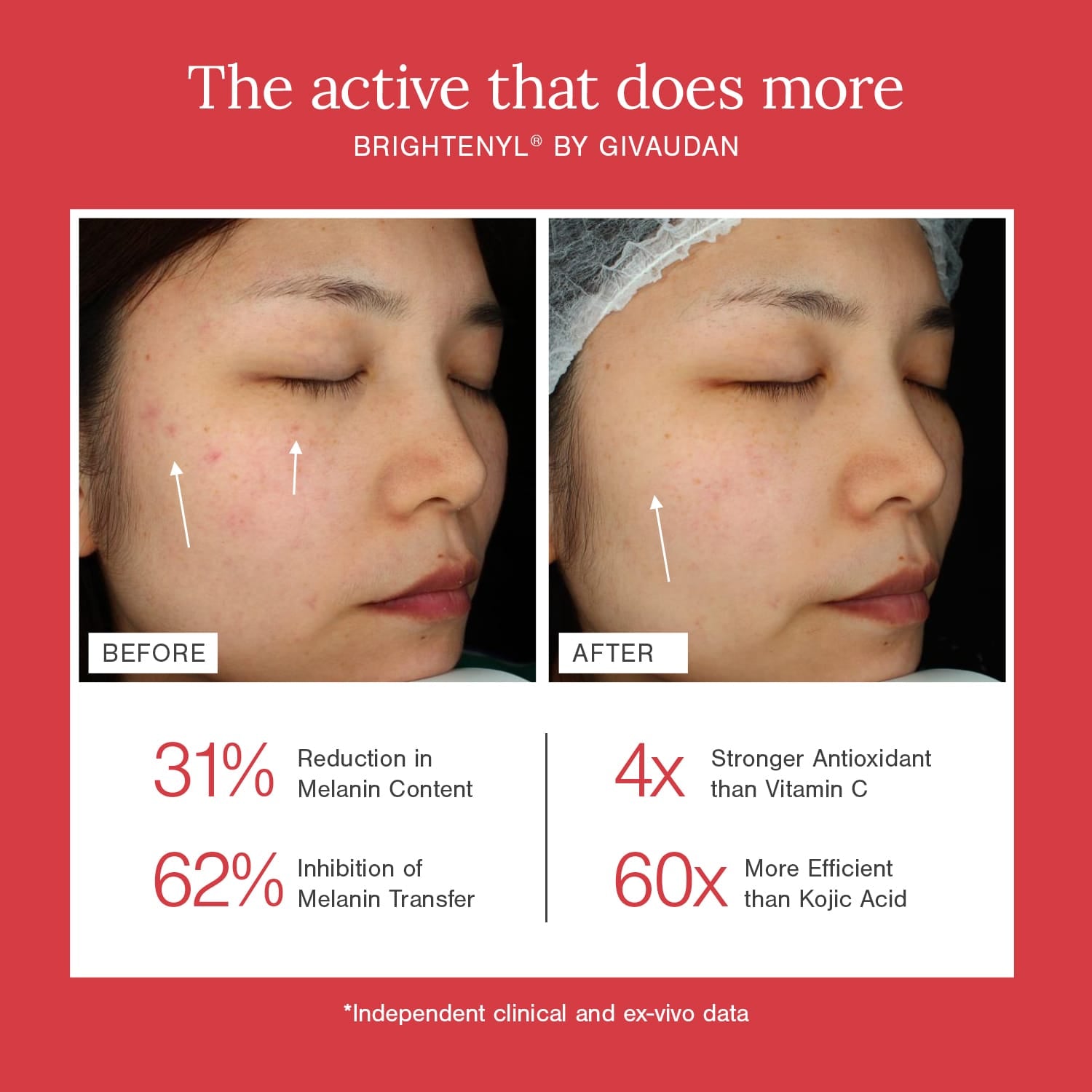 2% Alpha Arbutin + D-Gallic Acid Natural Face Serum