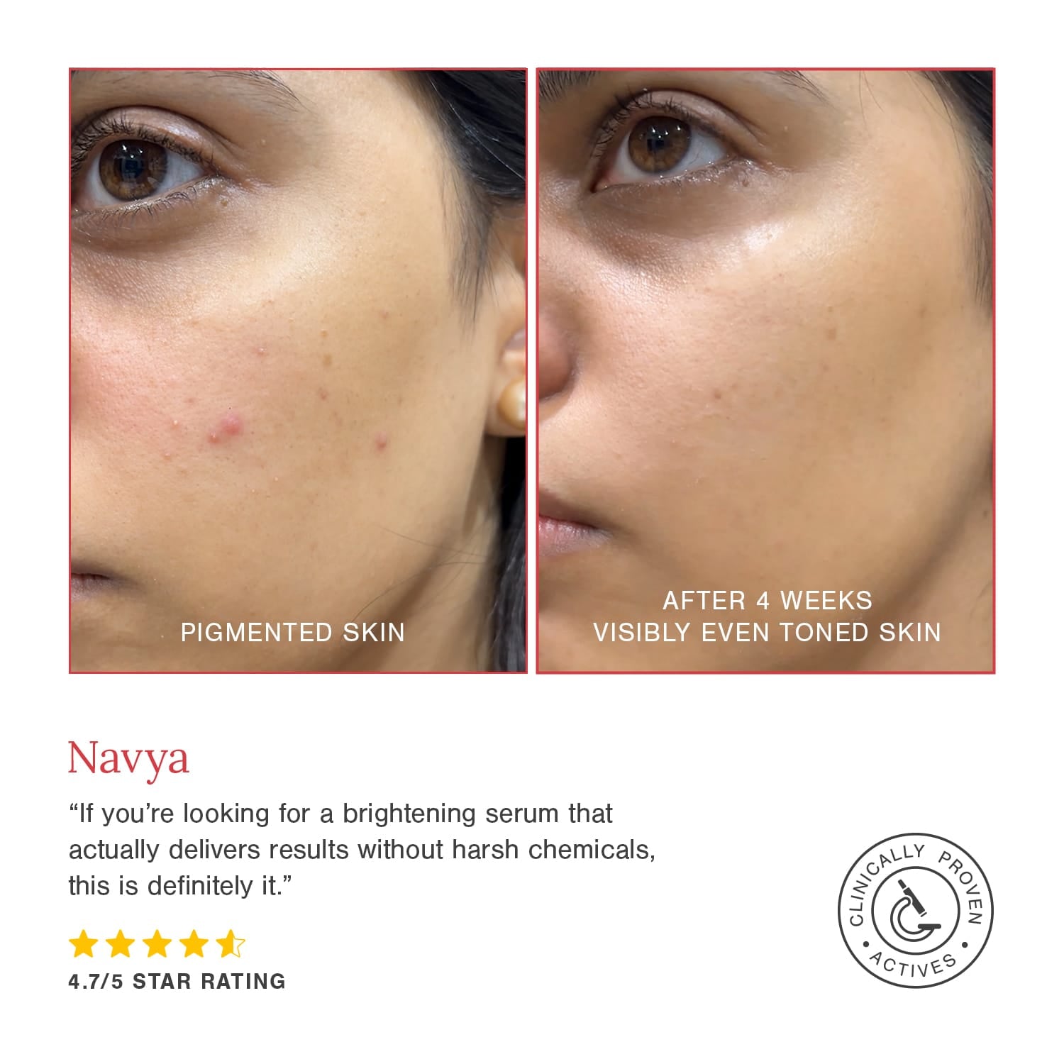 2% Alpha Arbutin + D-Gallic Acid Natural Face Serum