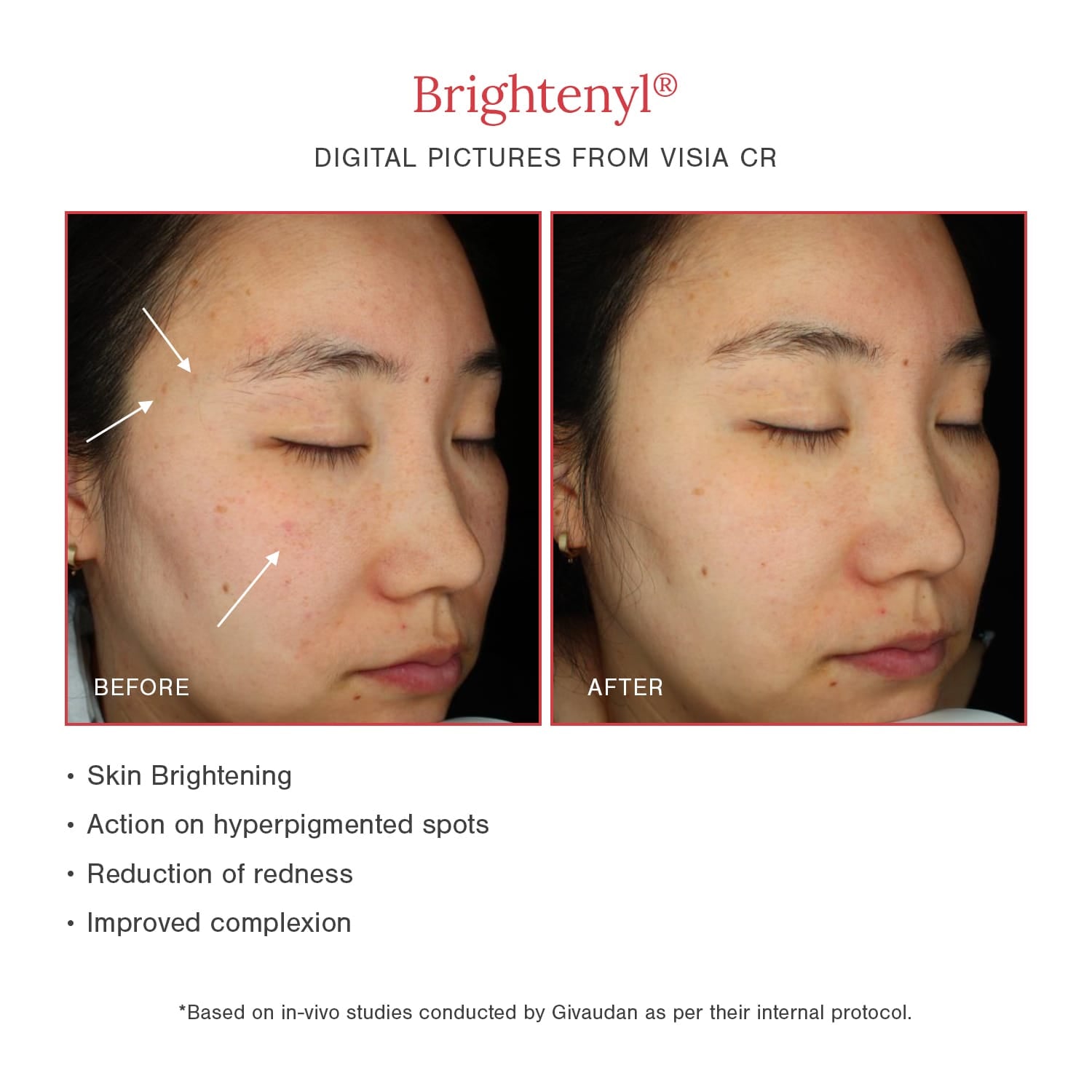2% Alpha Arbutin + D-Gallic Acid Natural Face Serum