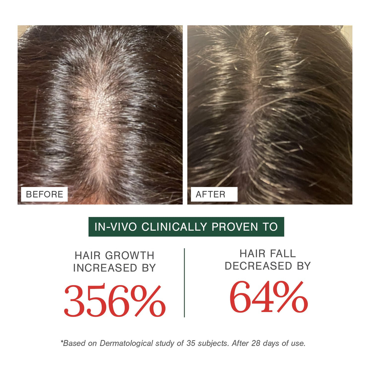 Anti-Hairfall Combo | Hair Growth Oil + Moisturising Shampoo + Rosemary Water