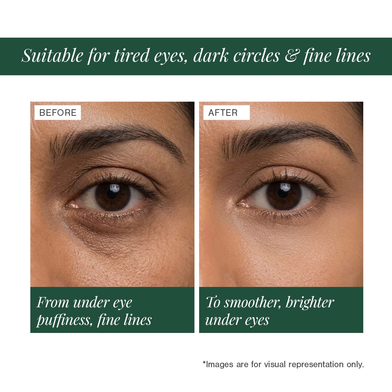 3% Caffeine + Peptides Eye Serum