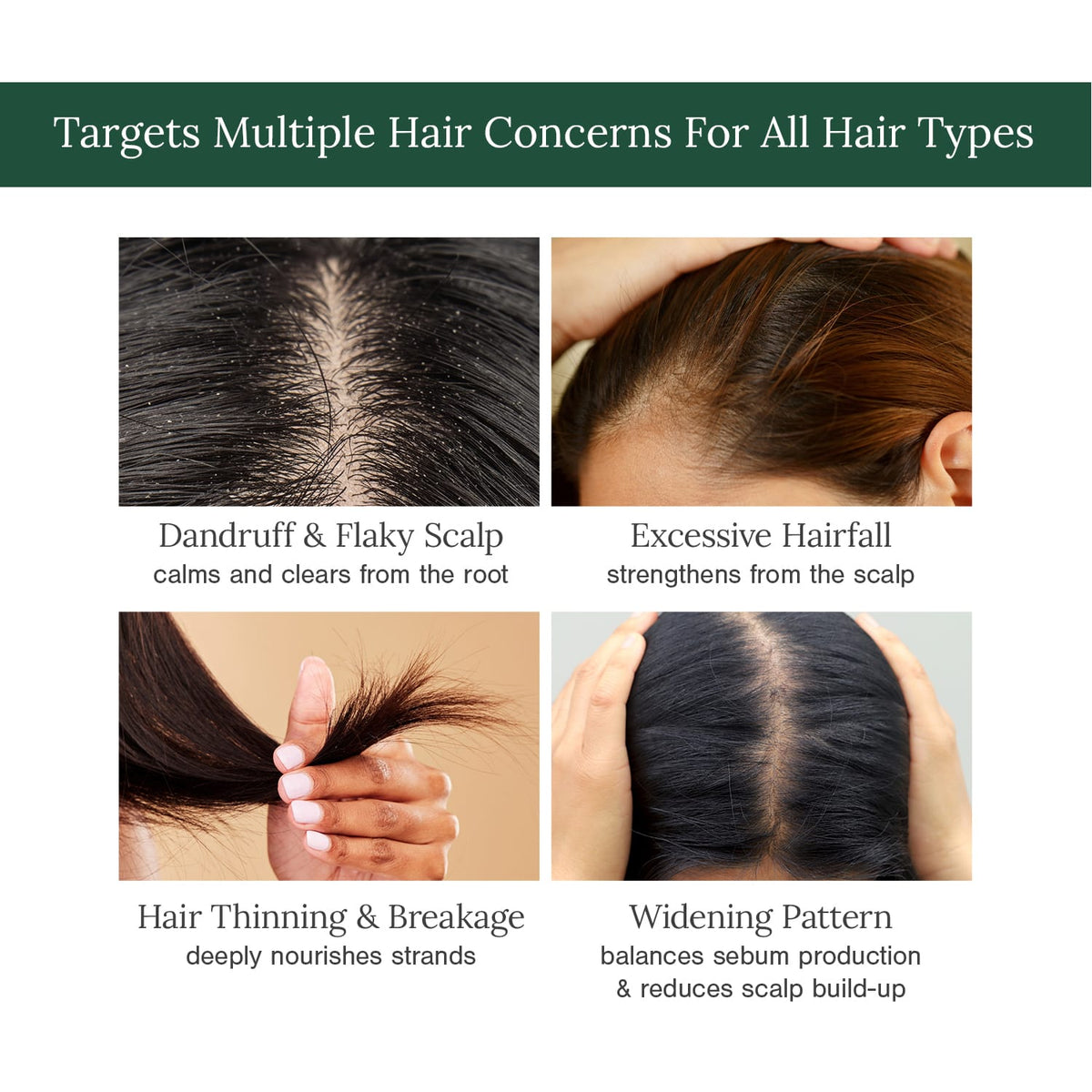 Anti-Dandruff Combo | Organic Anti-Dandruff Shampoo + 8% AHA +2% BHA Multi Use Exfoliating Toner