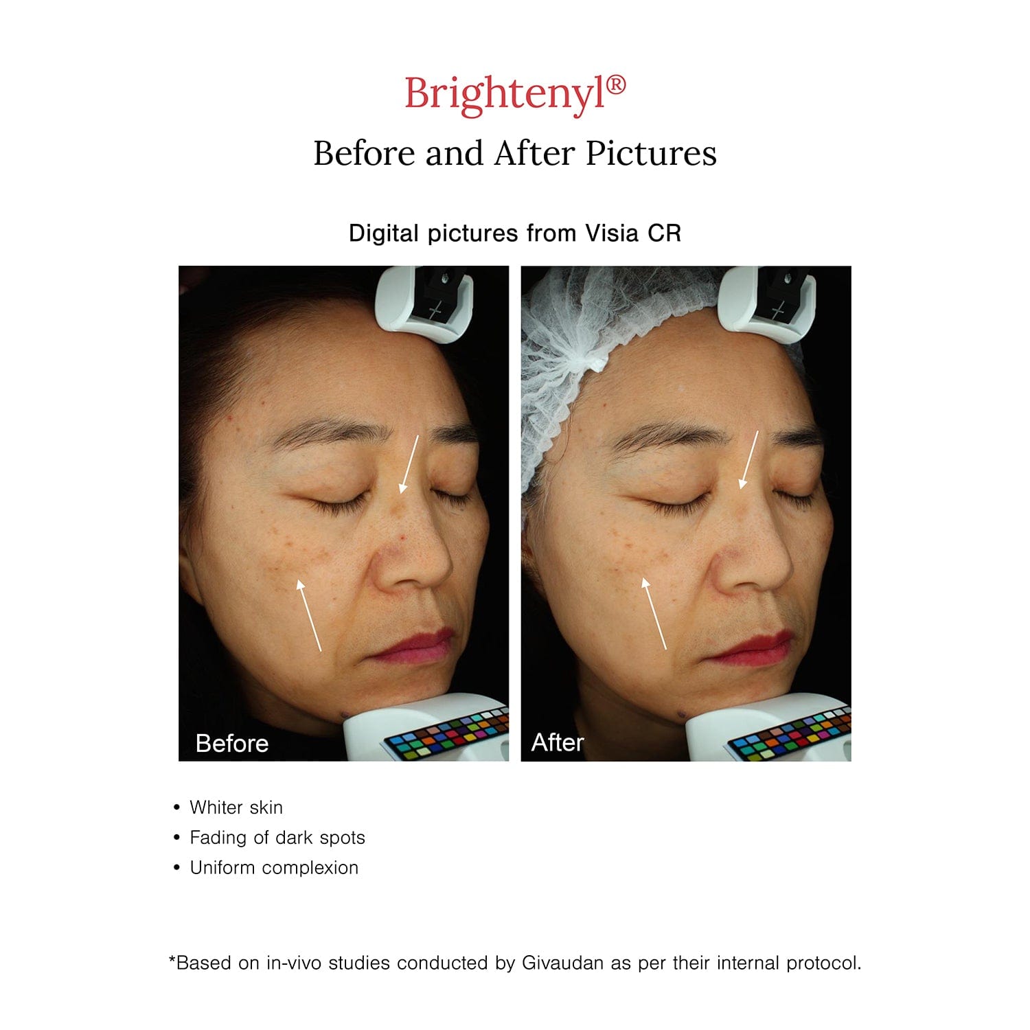 2% Alpha Arbutin + D-Gallic Acid Face Serum