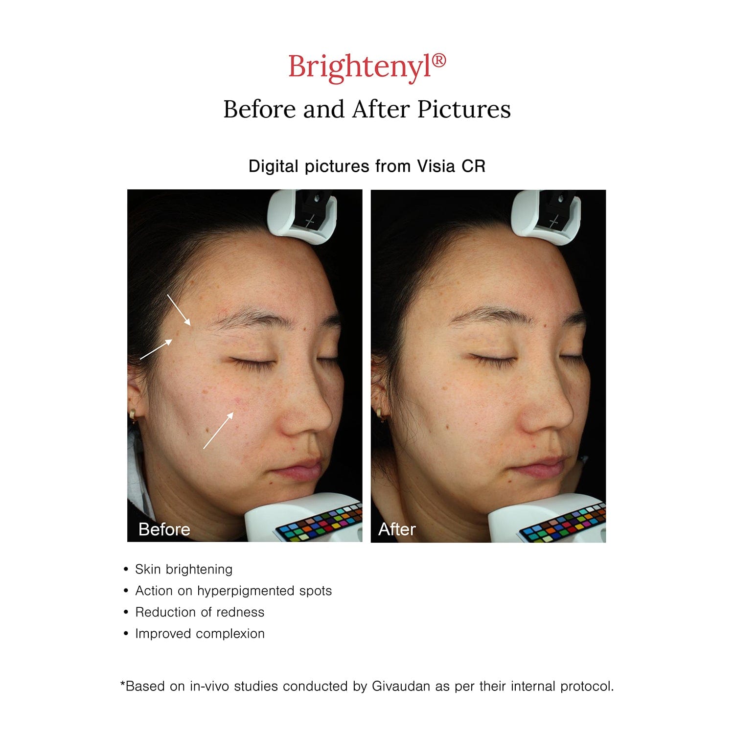 2% Alpha Arbutin + D-Gallic Acid Face Serum