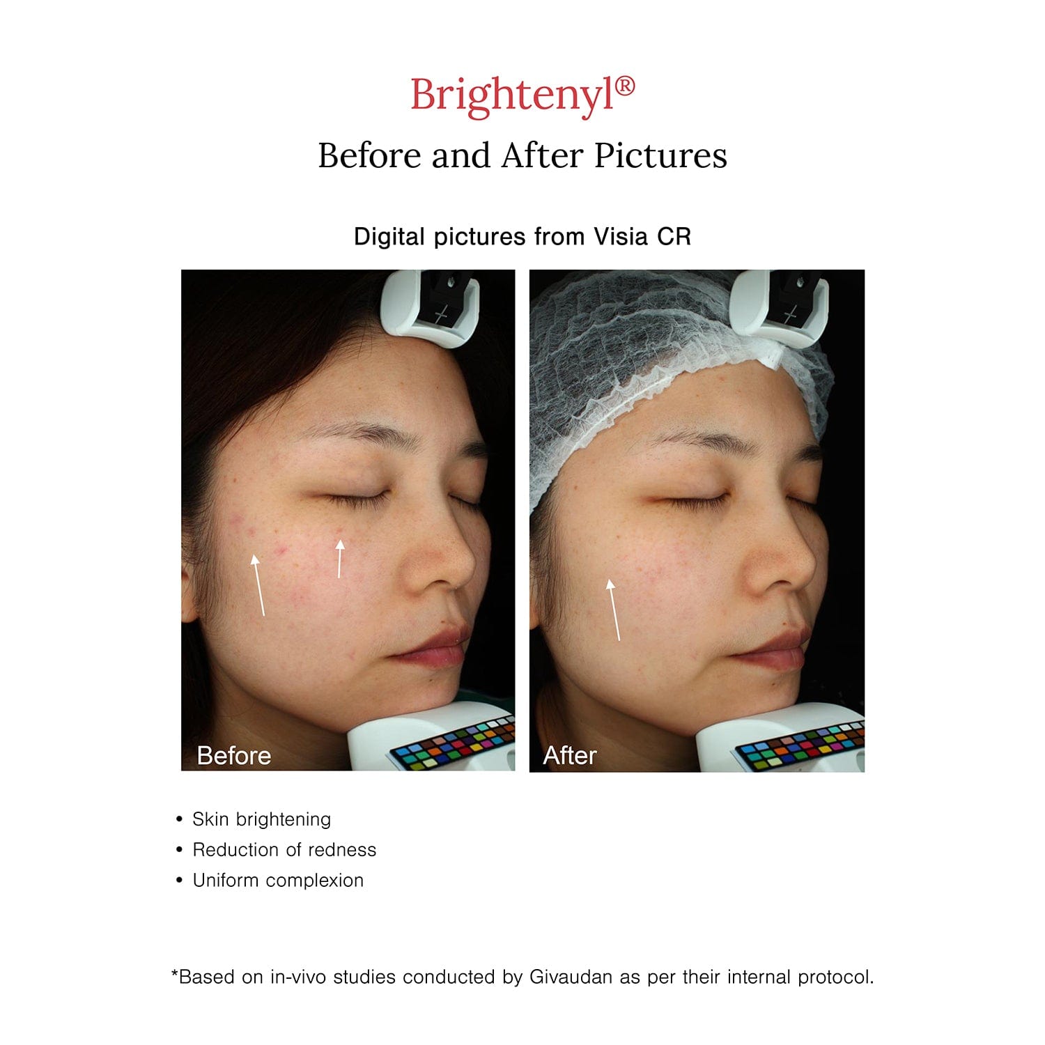 2% Alpha Arbutin + D-Gallic Acid Face Serum