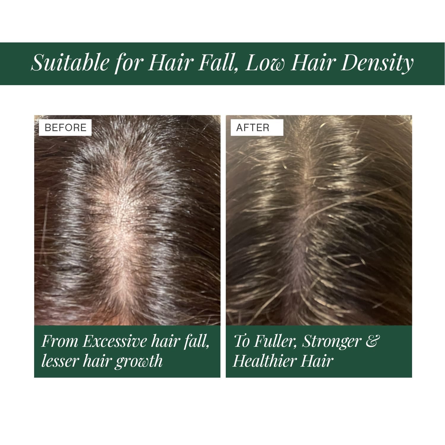 100% Natural Hair Growth Oil with Chilli + Rosemary