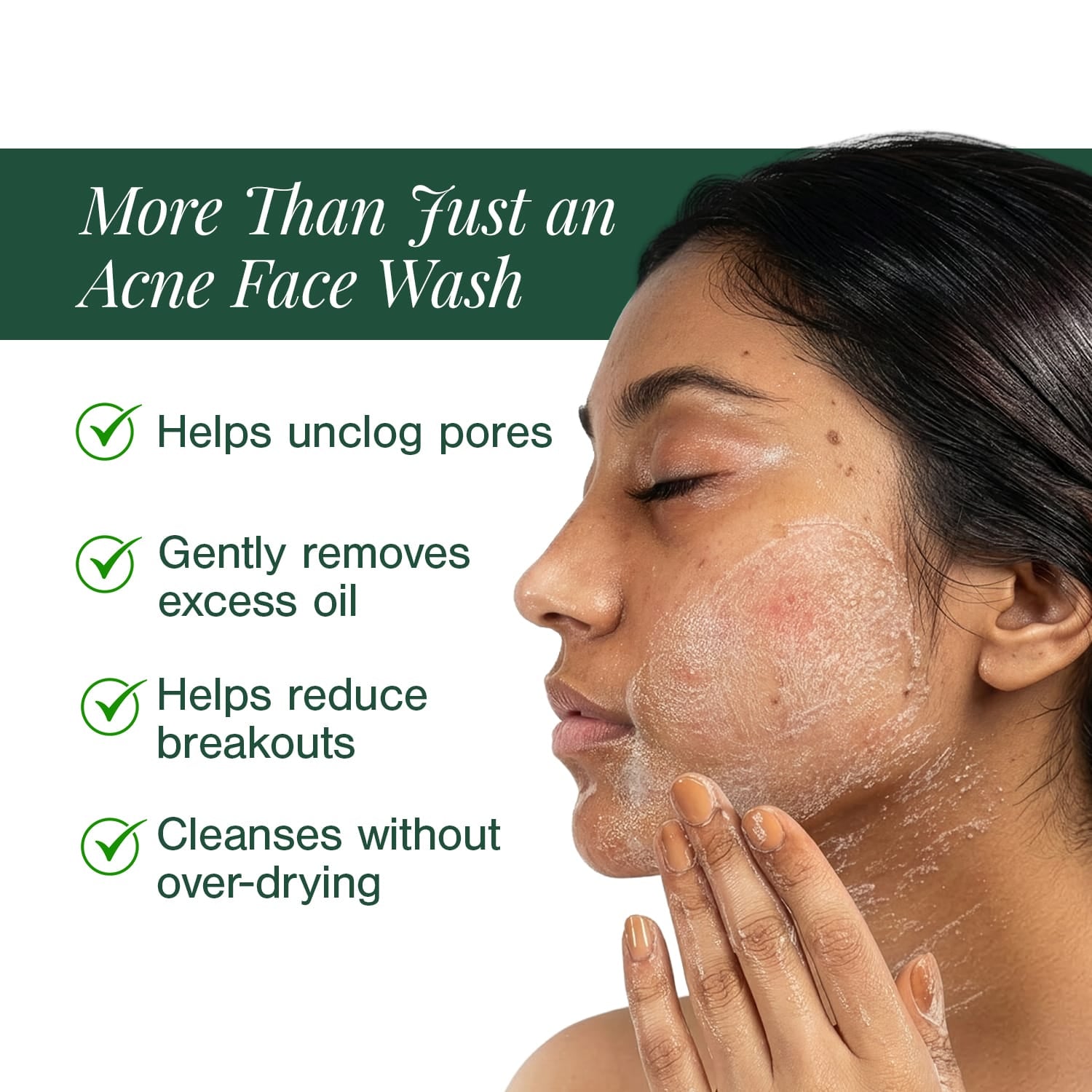 Certified Organic Acne & Pimples Control Face Wash Fortified with Hemp + Tea Tree