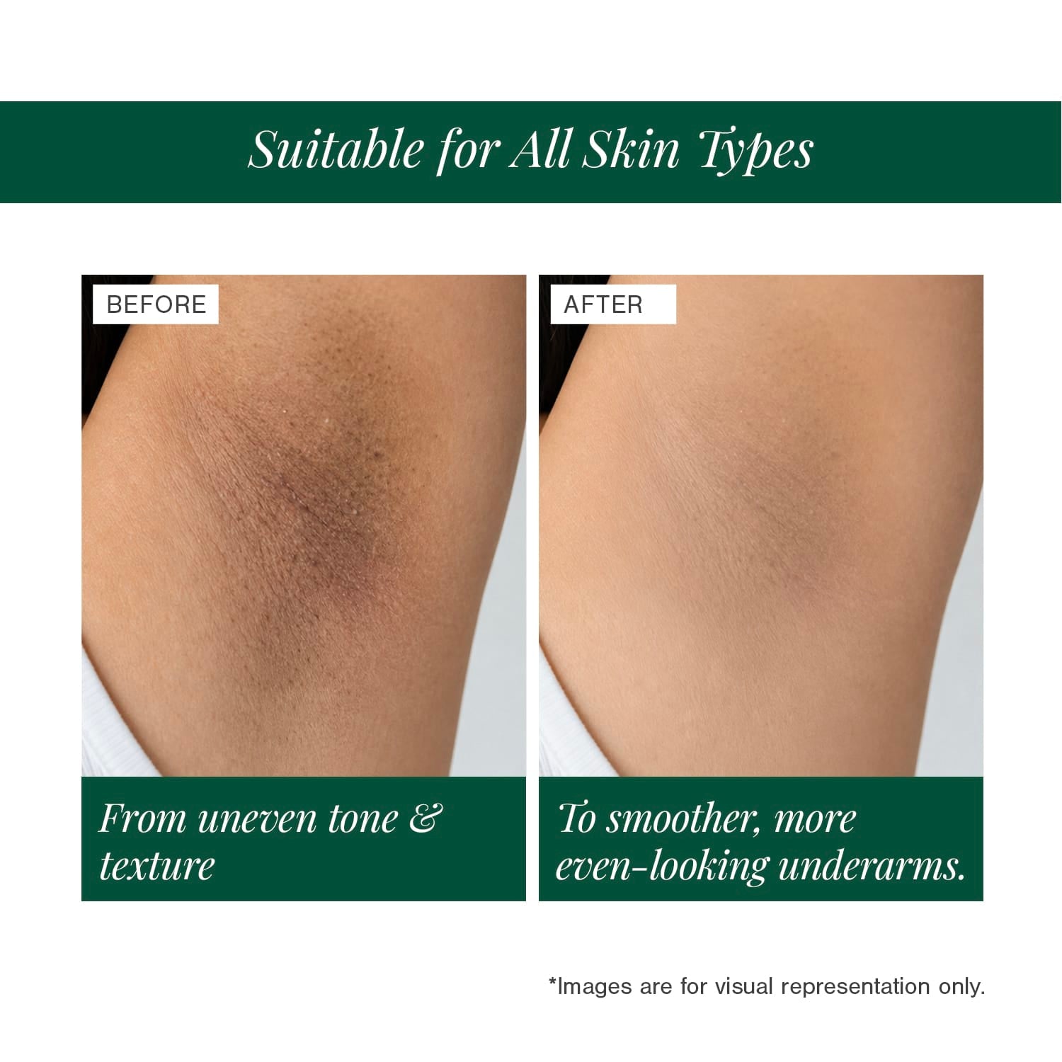 5% AHA + 2% BHA Underarm Roll-on Deodorant Fortified with Vanilla + Witch Hazel