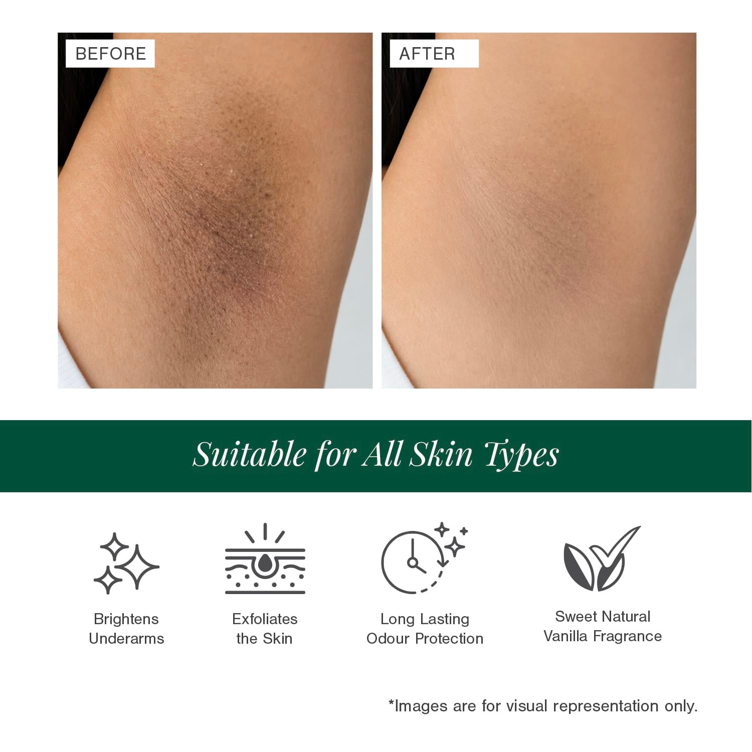 5% AHA + 2% BHA Underarm Roll-on Deodorant Fortified with Vanilla + Witch Hazel