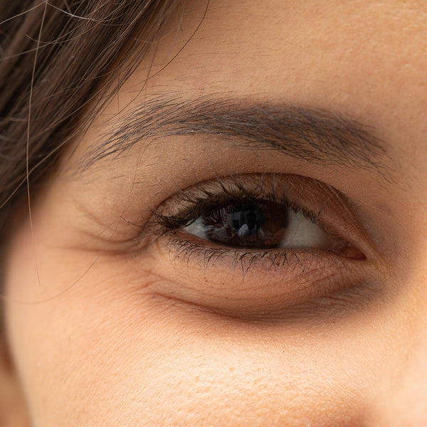 10 Effective Ways to Fade Away Dark Circles in 6 weeks