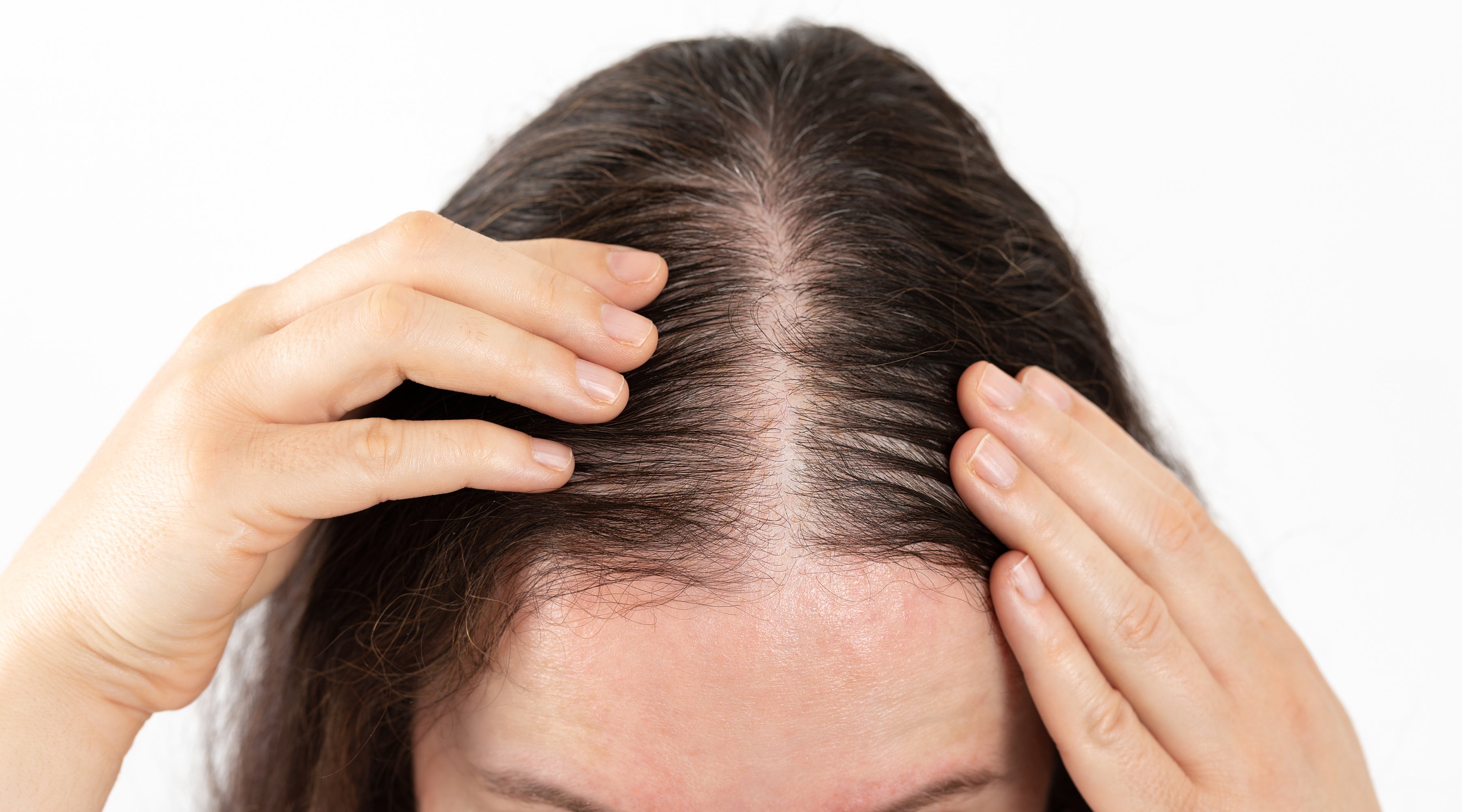 Hair Growth Timeline: What to Expect from Your Serum in Weeks 1 Through 12