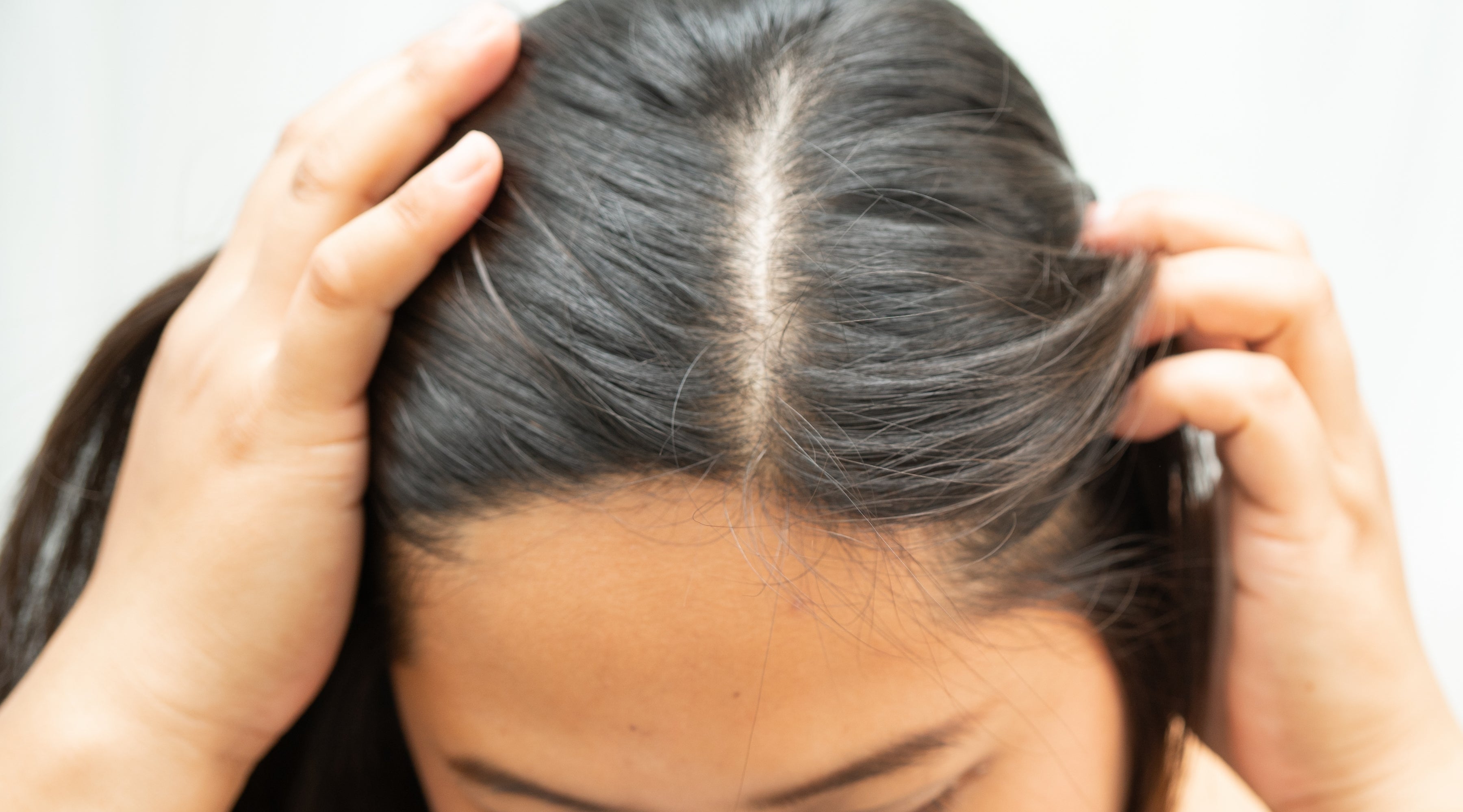 How to Keep Your Scalp Healthy During a Heat Wave: Oil, Sweat, and Sun Damage