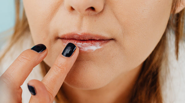 How to Treat Chapped Lips Effectively