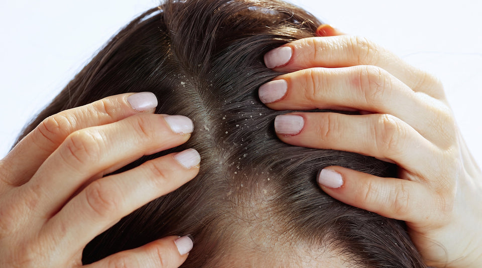 Oily Scalp but Dry Hair? Here's Why It Happens
