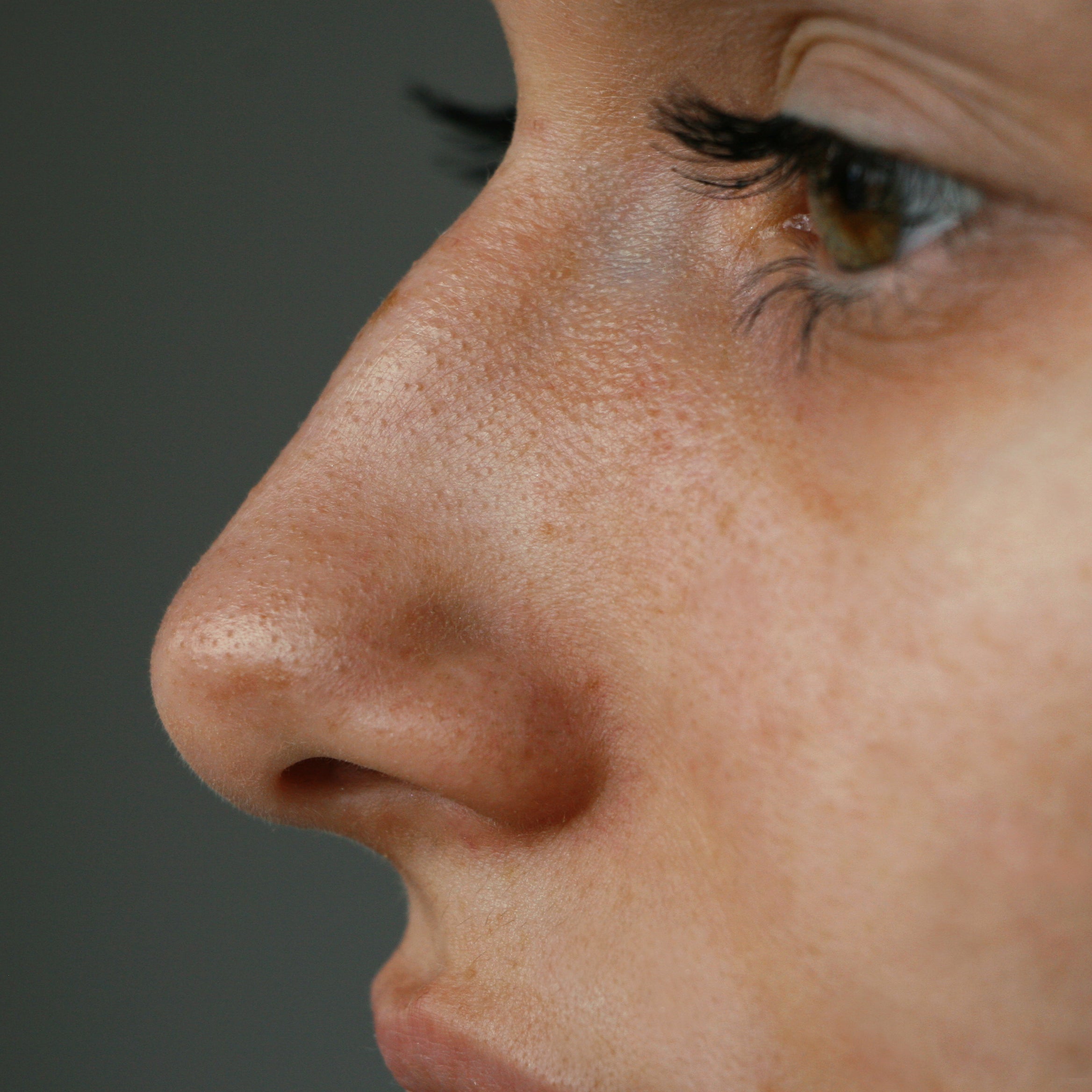 "How to get rid of Blackheads naturally at home? 4 Best Tips  PS: ADD BHA SERUM IN PRODUCTS"