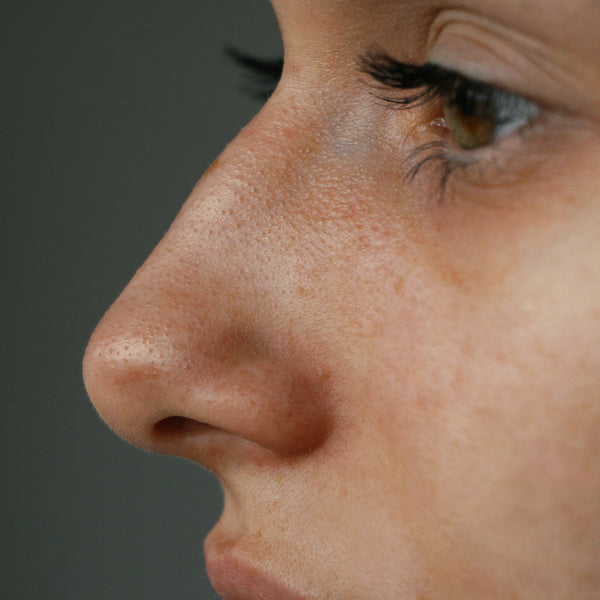 "How to get rid of Blackheads naturally at home? 4 Best Tips  PS: ADD BHA SERUM IN PRODUCTS"