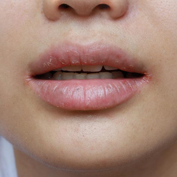 Perk up your Lips with a Natural Lip Care Routine