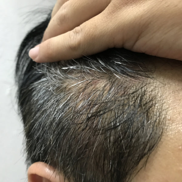 How to prevent Premature Greying of Hair in Teens and 20s?