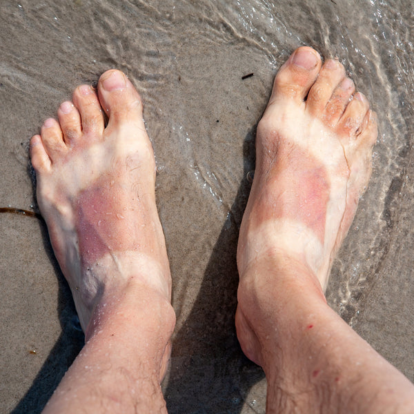How to remove tan naturally, home remedies for tan removal