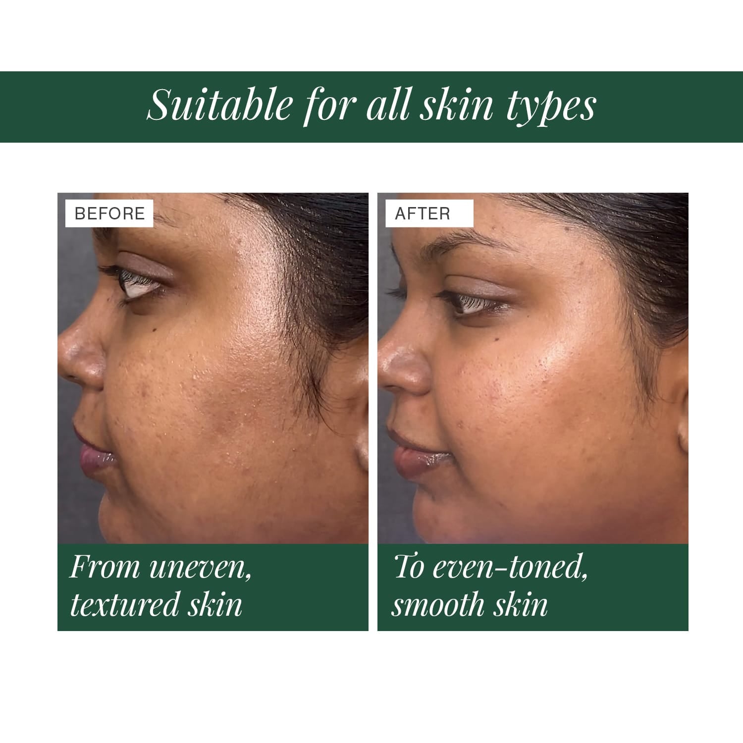 5% Lactic Acid + 3% Flower Acids Face Serum