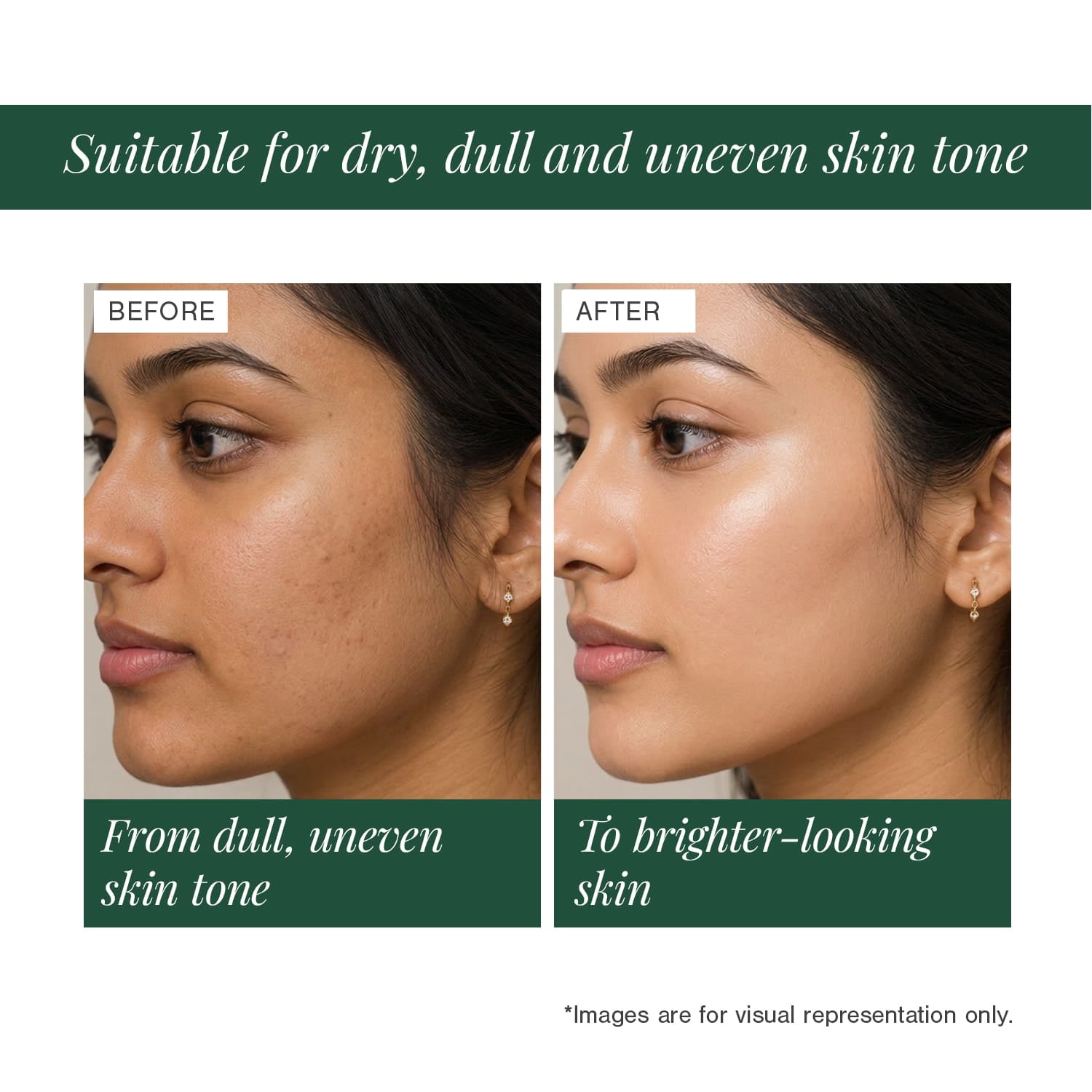 10% Vitamin C + EGCG Face Serum