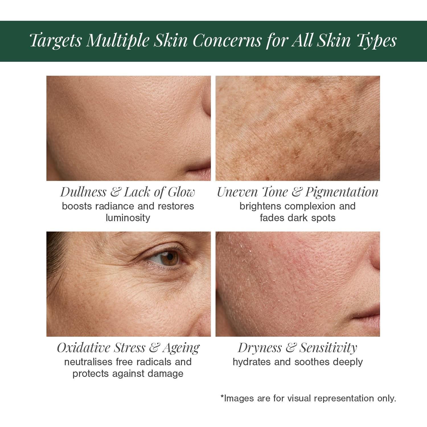 10% Vitamin C + EGCG Face Serum