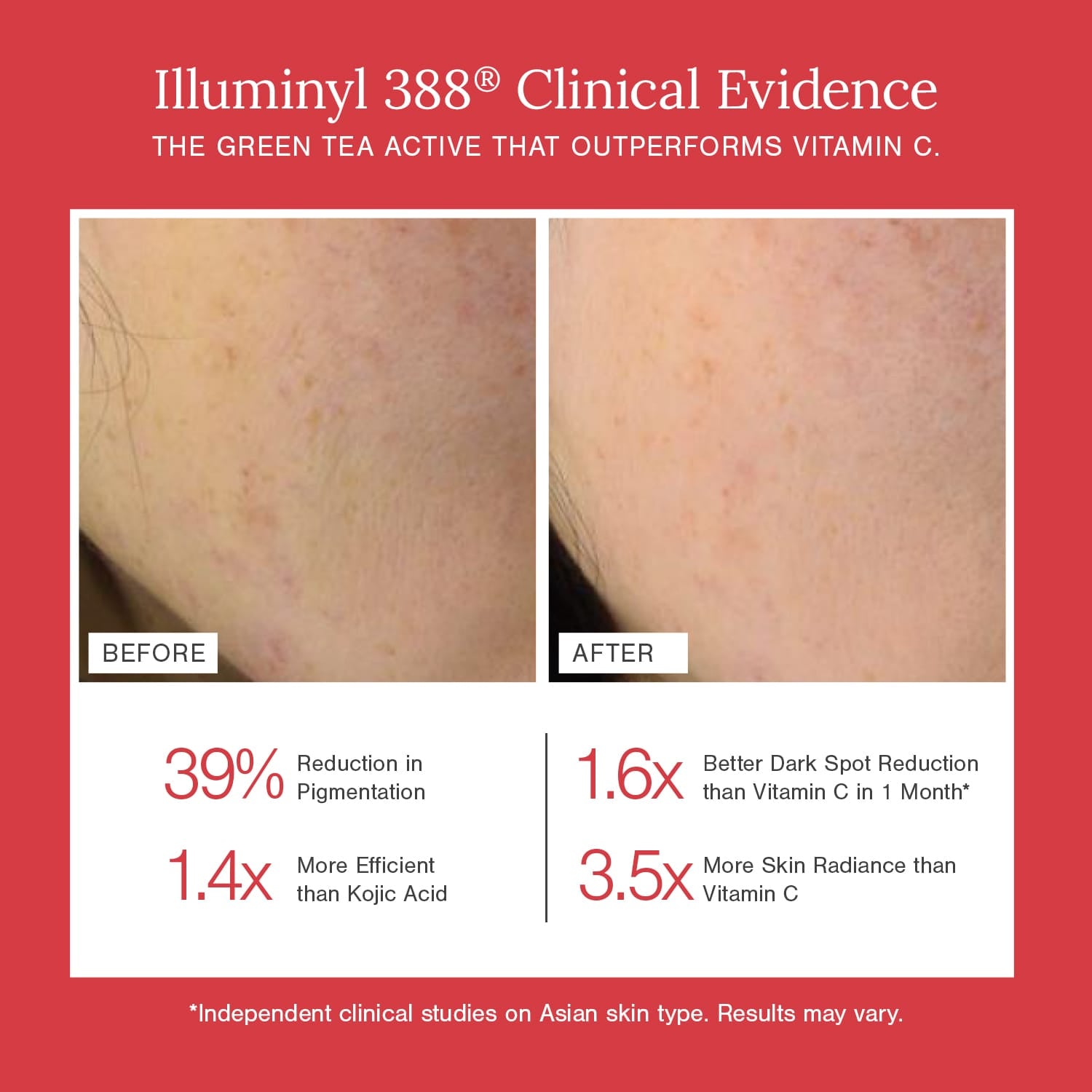 10% Vitamin C + EGCG Face Serum