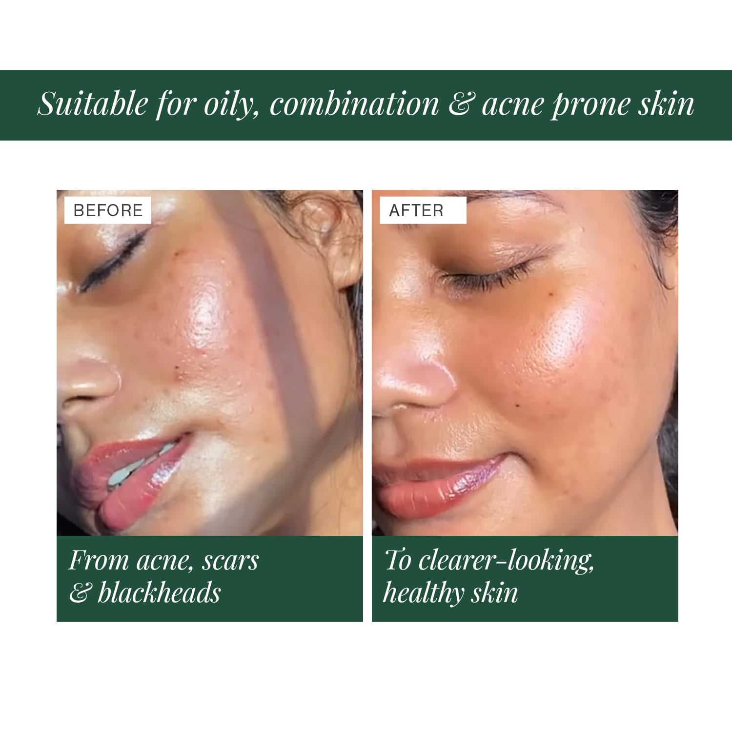 2% BHA + Zinc PCA Face Serum