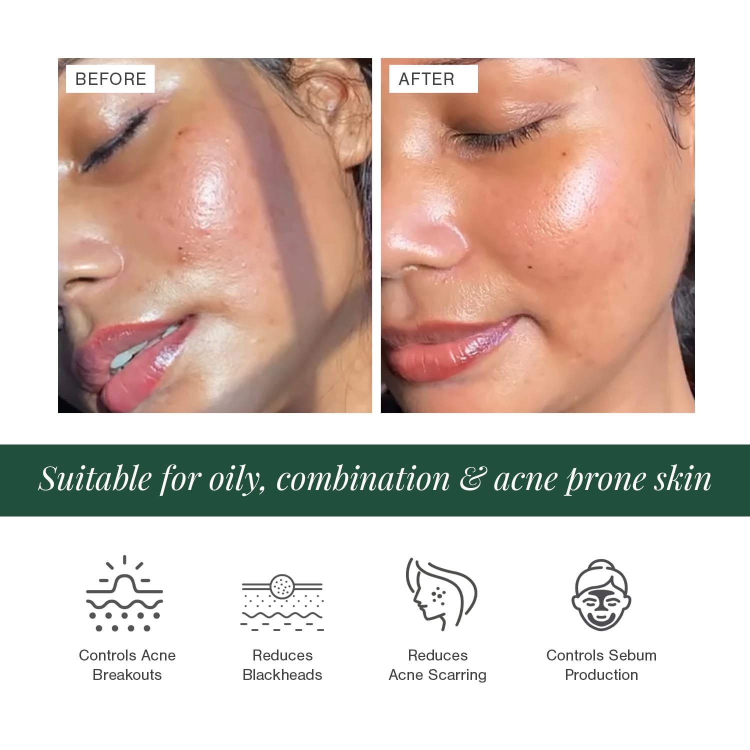 2% BHA + Zinc PCA Face Serum