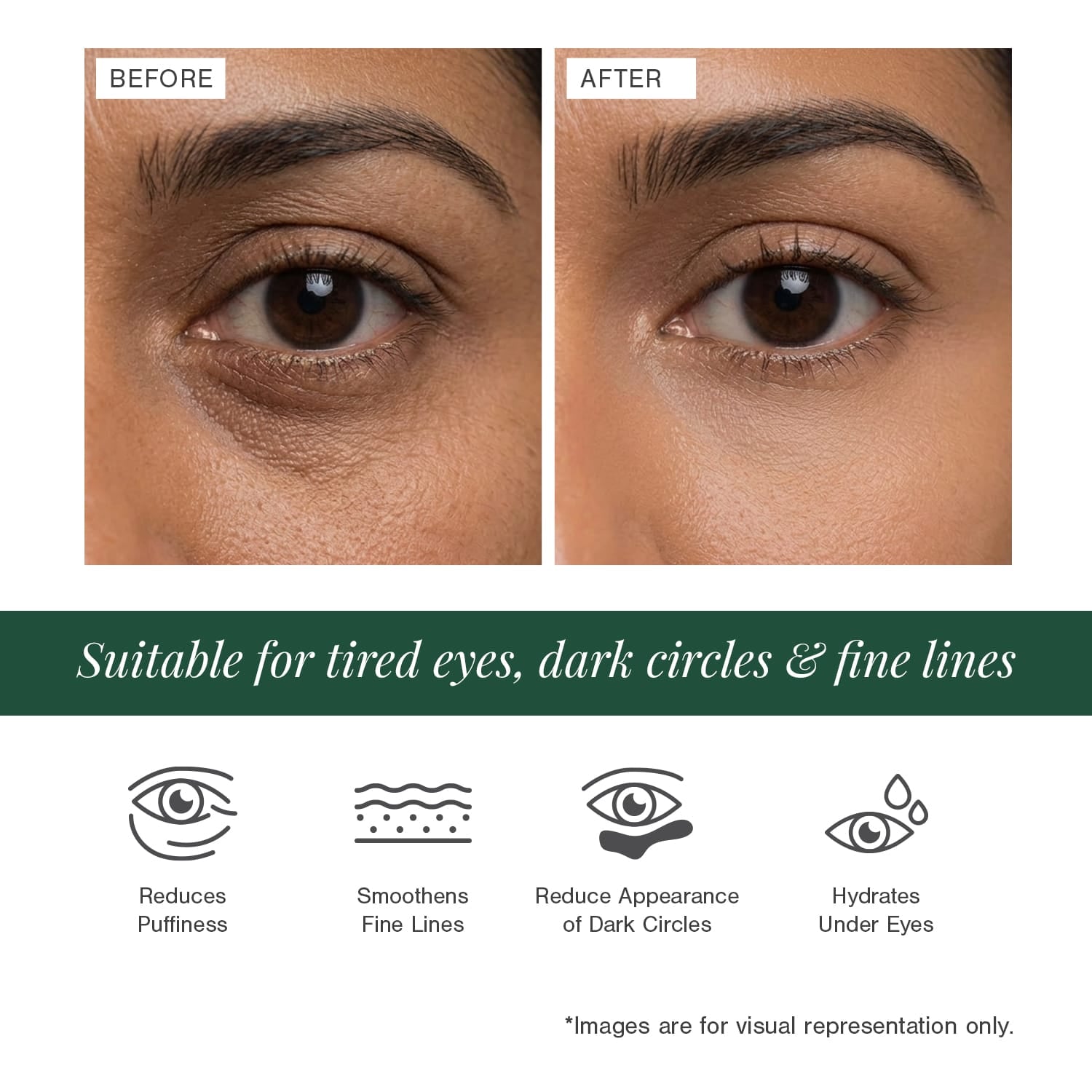 3% Caffeine + Peptides Eye Serum