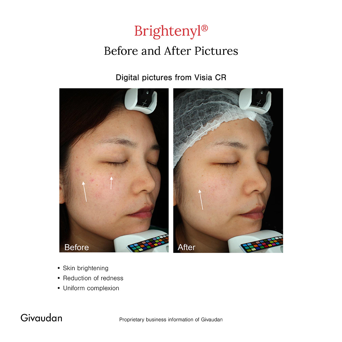 2% Alpha Arbutin + D-Gallic Acid Face Serum