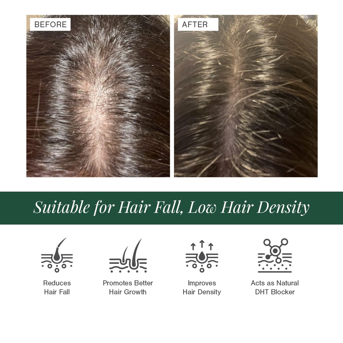 100% Natural Hair Growth Oil with Chilli + Rosemary, 100 ml