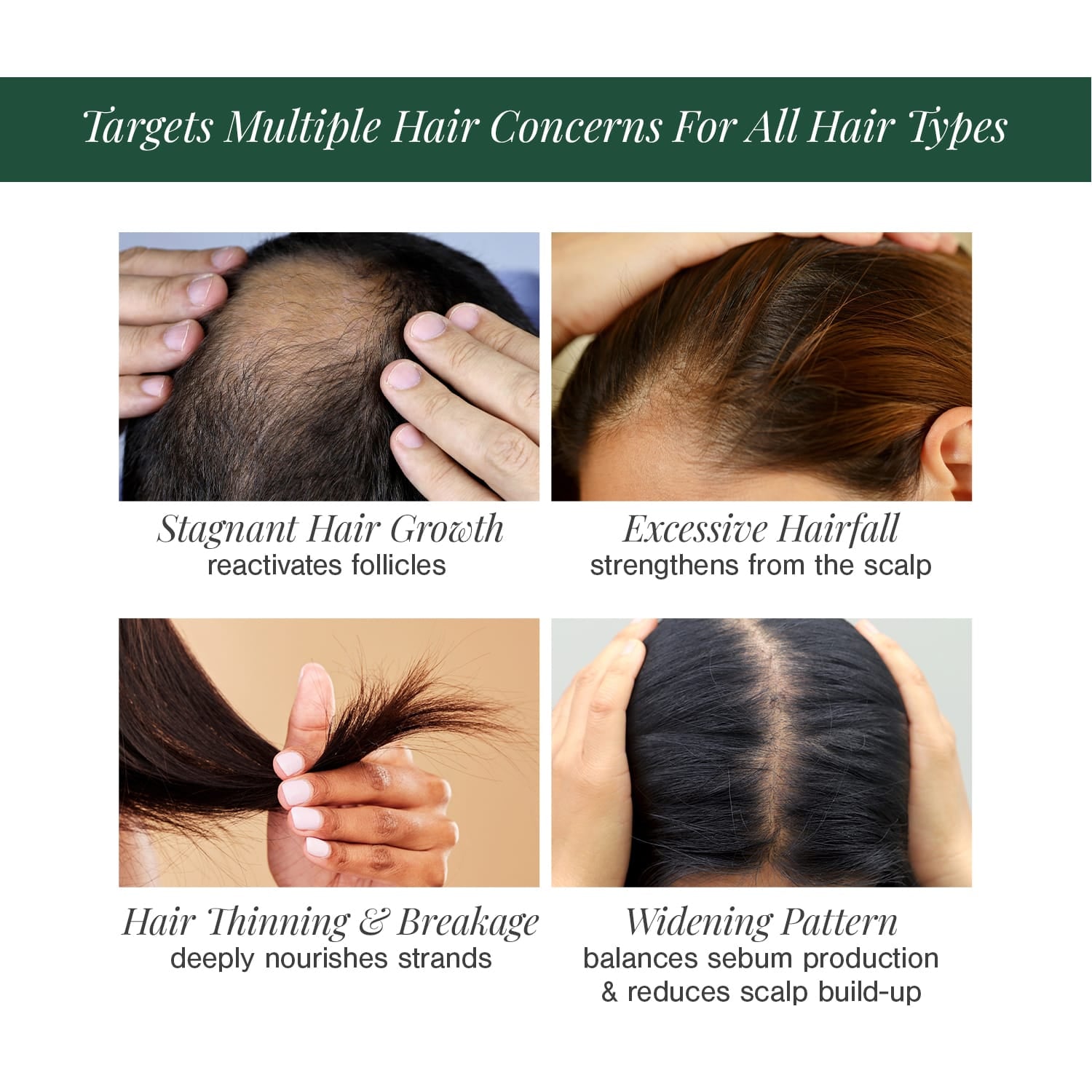 100% Natural Hair Growth Oil with Chilli + Rosemary