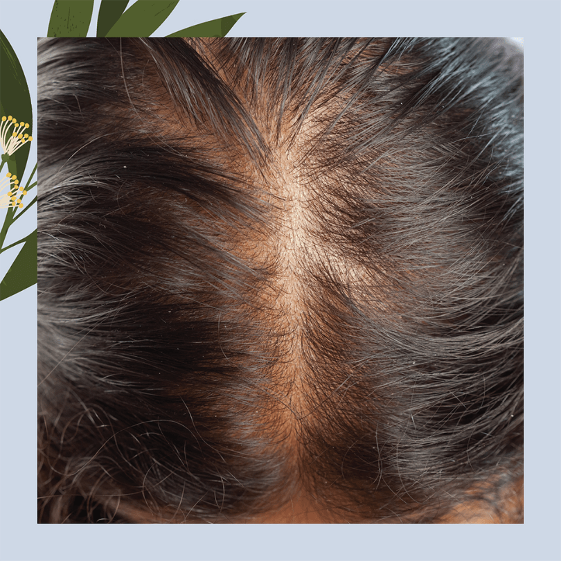 files/HairGrowthEssential.png