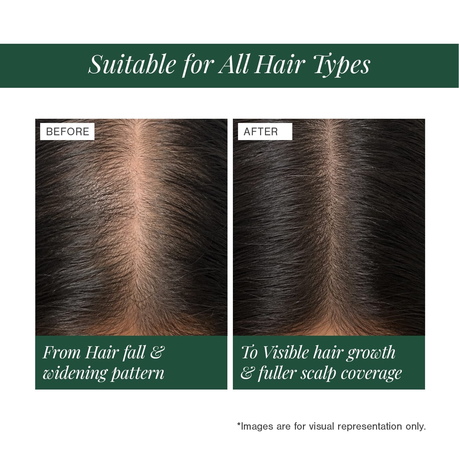 Stemcells + Multi-Peptide Hair Growth Serum Fortified With Redensyl & Anagain