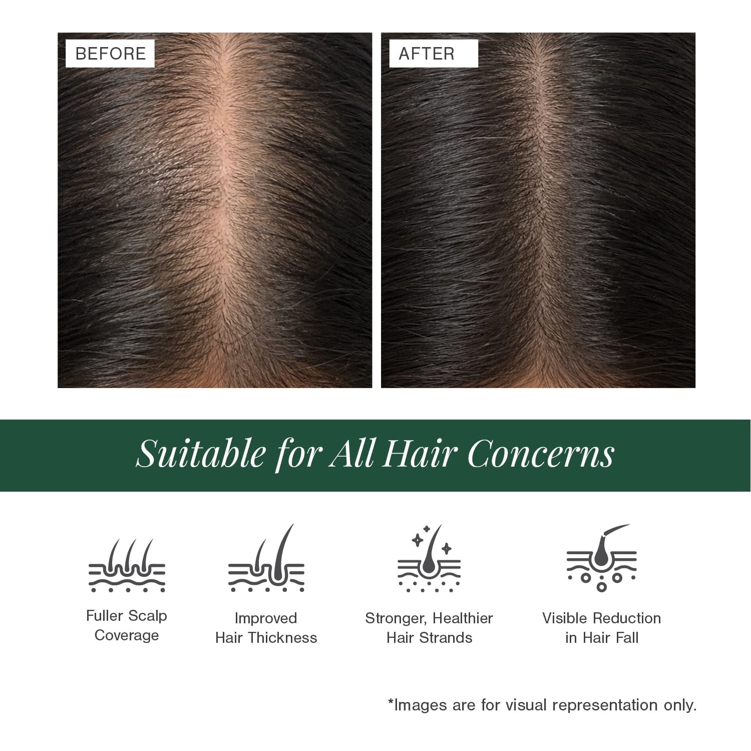 Stemcells + Multi-Peptide Hair Growth Serum Fortified With Redensyl & Anagain