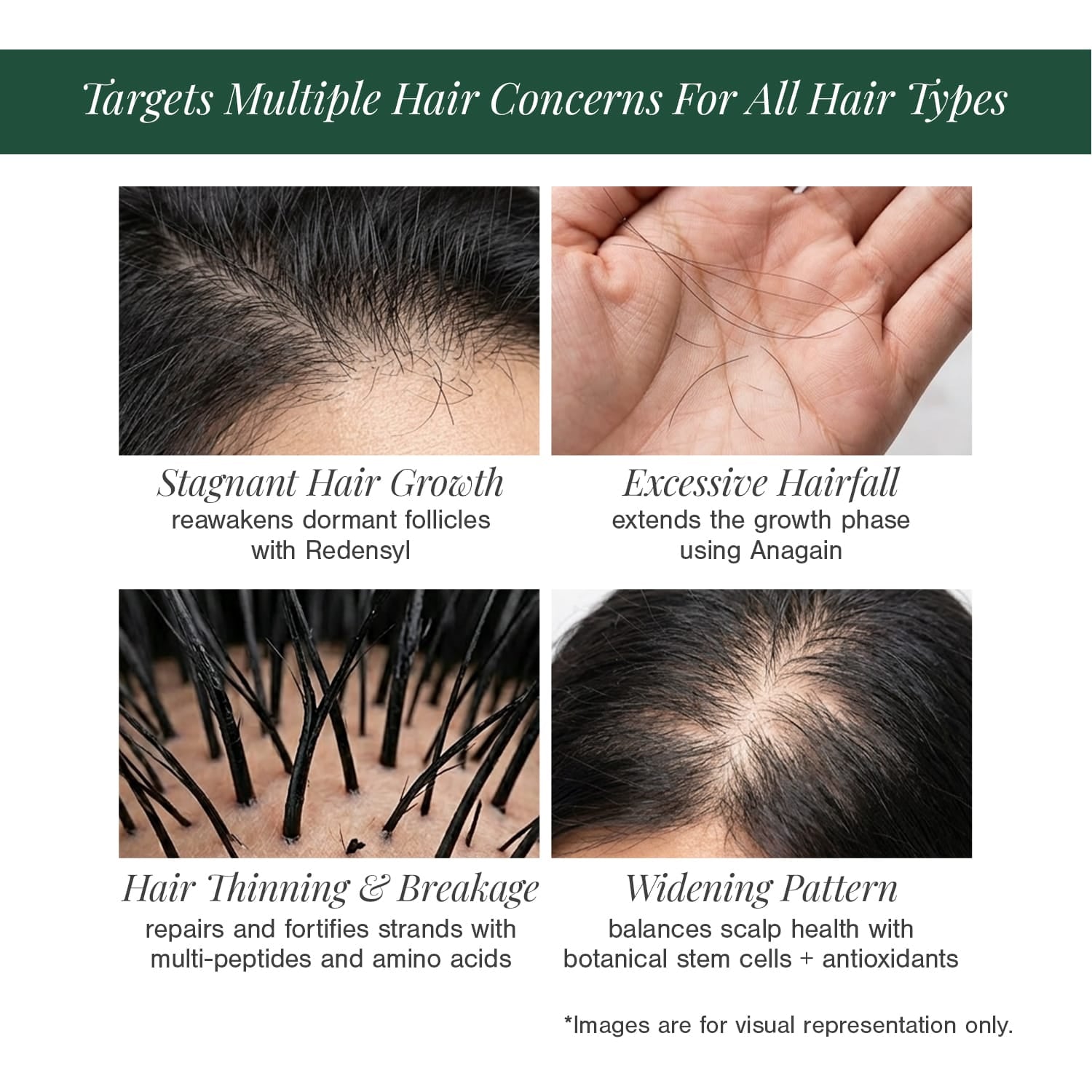 Stemcells + Multi-Peptide Hair Growth Serum Fortified With Redensyl & Anagain