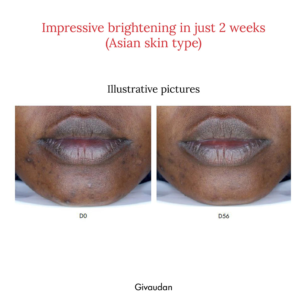10% Vitamin C + EGCG Face Serum