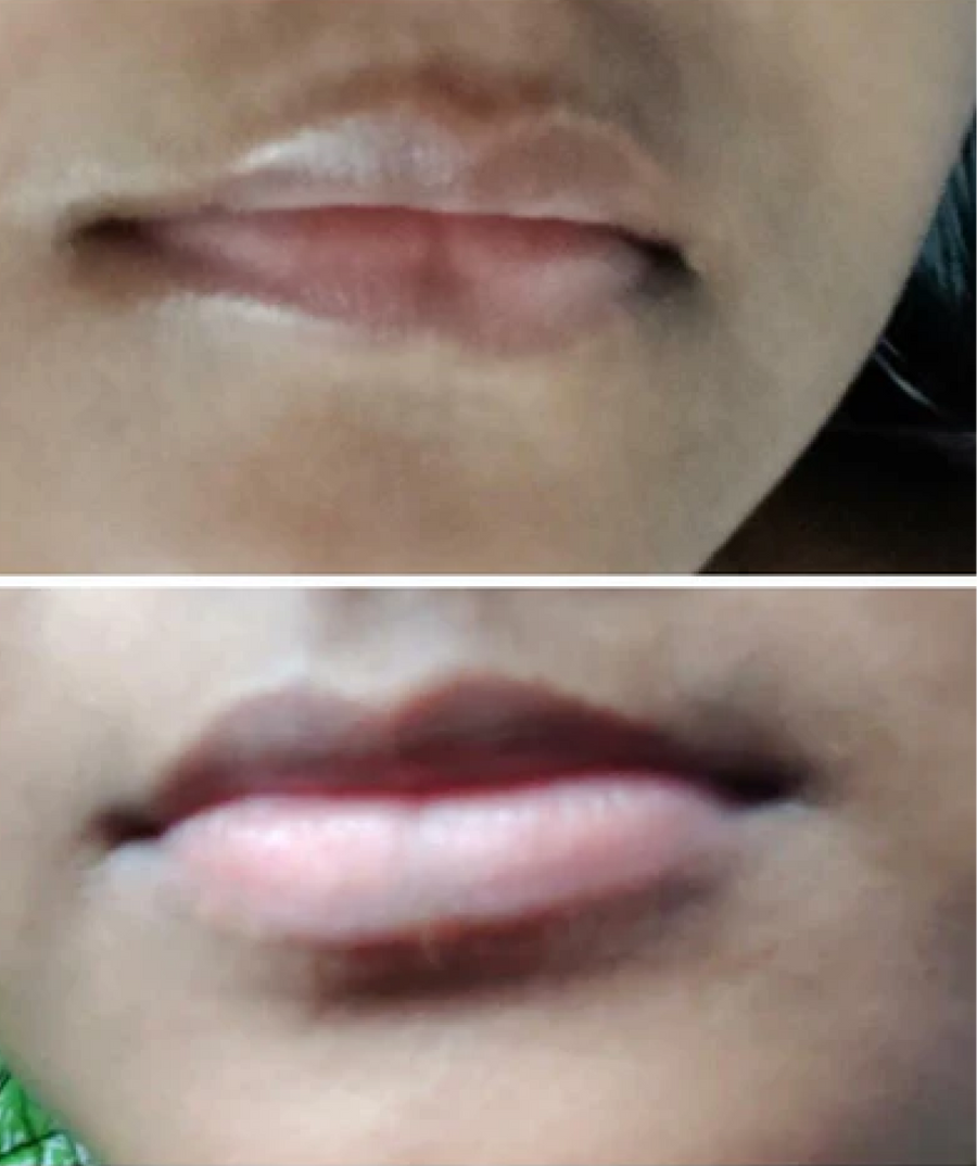 Photo shared by Priyadharshini Rathinam
