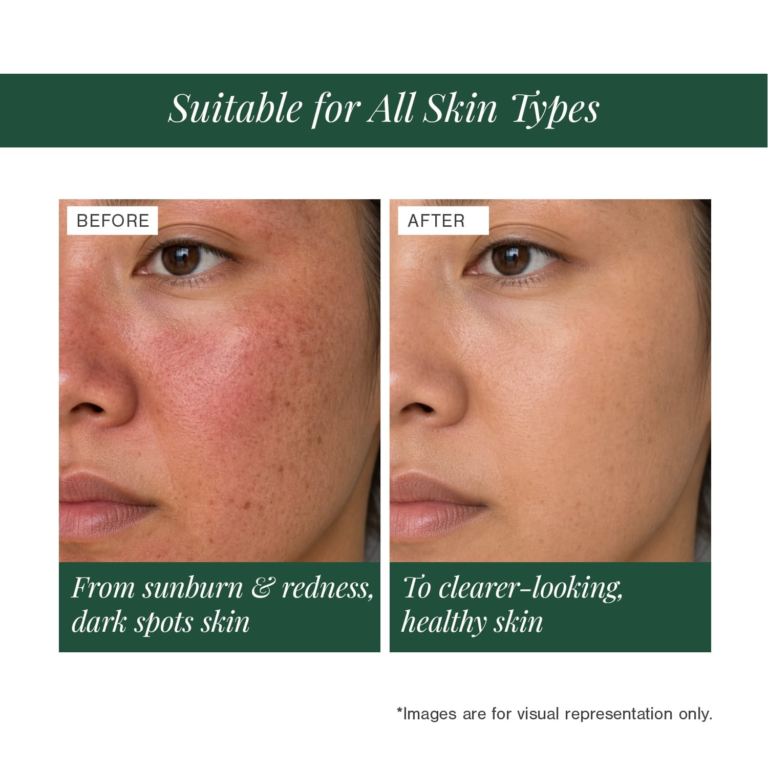Moisturising Mineral Sunscreen" to "Mineral Sunscreen SPF 40 — Certified Organic